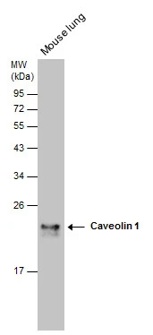 Caveolin 1 antibody [N1N3] detects Caveolin 1 protein by western blot analysis. Mouse tissue extracts (50 μg) was separated by 12% SDS-PAGE, and the membrane was blotted with Caveolin 1 antibody [N1N3] (GTX100205) diluted at 1:500. The HRP-conjugated anti-rabbit IgG antibody (GTX213110-01) was used to detect the primary antibody.