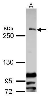 Sample (30 ug of whole cell lysate) A: Raji 5% SDS PAGE GTX100212 diluted at 1:1000 The HRP-conjugated anti-rabbit IgG antibody (GTX213110-01) was used to detect the primary antibody.