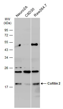 Various whole cell extracts (30 μg) were separated by 12% SDS-PAGE, and the membrane was blotted with Cofilin 2 antibody (GTX100213) diluted at 1:1000. The HRP-conjugated anti-rabbit IgG antibody (GTX213110-01) was used to detect the primary antibody.