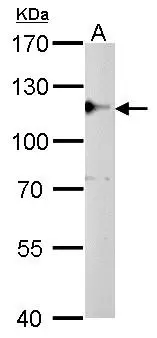 CYLD antibody detects CYLD protein by western blot analysis. A. 50 μg rat brain lysate/extract 7.5% SDS-PAGE CYLD antibody (GTX100228) dilution: 1:500 The HRP-conjugated anti-rabbit IgG antibody (GTX213110-01) was used to detect the primary antibody.