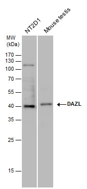 DAZL antibody detects DAZL protein by western blot analysis. Whole cell extracts (30 μg) and Mouse tissue extracts (50 μg) were separated by 12% SDS-PAGE, and the membrane was blotted with DAZL antibody (GTX100230) diluted at a dilution of 1:1000.
