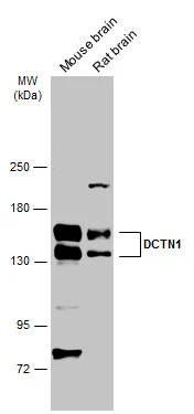 Various tissue extracts (50 μg) were separated by 5% SDS-PAGE, and the membrane was blotted with DCTN1 antibody [C3], C-term (GTX100231) diluted at 1:2000. The HRP-conjugated anti-rabbit IgG antibody (GTX213110-01) was used to detect the primary antibody.