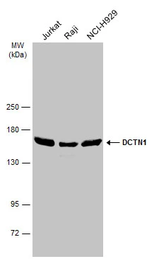 Various whole cell extracts (30 μg) were separated by 5% SDS-PAGE, and the membrane was blotted with DCTN1 antibody [C3], C-term (GTX100231) diluted at 1:2500. The HRP-conjugated anti-rabbit IgG antibody (GTX213110-01) was used to detect the primary antibody.