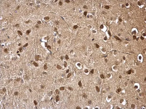 DDB1 antibody [C3], C-term detects DDB1 protein at cytosol and nucleus on mouse hind brain by immunohistochemical analysis. Sample: Paraffin-embedded mouse hind brain. DDB1 antibody [C3], C-term (GTX100232) dilution: 1:500. 
 Antigen Retrieval: Trilogy? (EDTA based, pH 8.0) buffer, 15min
