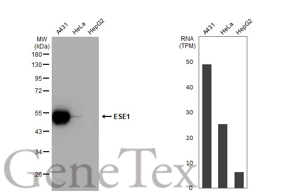Various whole cell extracts (30 μg) were separated by 10% SDS-PAGE, and the membrane was blotted with ESE1 antibody [C2C3], C-term (GTX100250) diluted at 1:1000. The HRP-conjugated anti-rabbit IgG antibody (GTX213110-01) was used to detect the primary antibody. Corresponding RNA expression data for the same cell lines are based on Human Protein Atlas program.