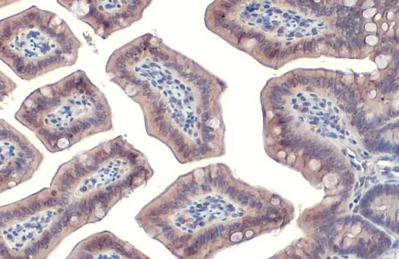 Cortactin antibody [N1], N-term detects Cortactin protein at cell membrane and cytoplasm by immunohistochemical analysis. Sample: Paraffin-embedded mouse intestine. Cortactin stained by Cortactin antibody [N1], N-term (GTX100253) diluted at 1:500. Antigen Retrieval: Citrate buffer, pH 6.0, 15 min