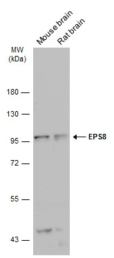 Various tissue extracts (50 μg) were separated by 7.5% SDS-PAGE, and the membrane was blotted with EPS8 antibody [C3], C-term (GTX100254) diluted at 1:1000. The HRP-conjugated anti-rabbit IgG antibody (GTX213110-01) was used to detect the primary antibody.