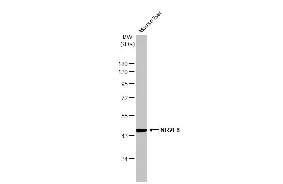 Mouse tissue extract (50 μg) was separated by 10% SDS-PAGE, and the membrane was blotted with NR2F6 antibody (GTX100255) diluted at 1:1000. The HRP-conjugated anti-rabbit IgG antibody (GTX213110-01) was used to detect the primary antibody, and the signal was developed with Trident ECL plus-Enhanced.