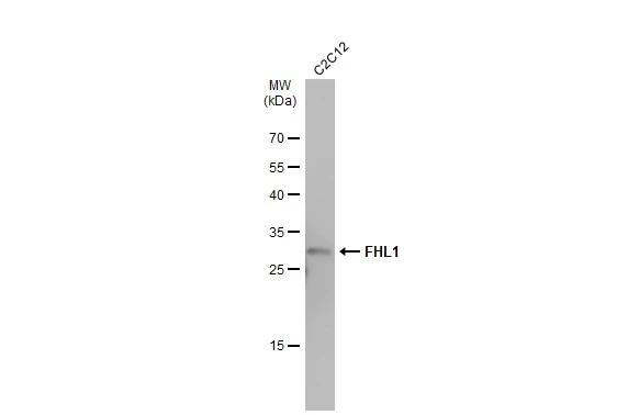 Whole cell extract (30 μg) was separated by 12% SDS-PAGE, and the membrane was blotted with FHL1 antibody (GTX100266) diluted at 1:500. The HRP-conjugated anti-rabbit IgG antibody (GTX213110-01) was used to detect the primary antibody.