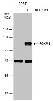Non-transfected (–) and transfected (+) 293T whole cell extracts (30 μg) were separated by 7.5% SDS-PAGE, and the membrane was blotted with FOXM1 antibody [C3], C-term (GTX100276) diluted at 1:5000.