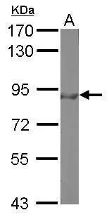 Sample (50 μg of whole cell lysate) A: Mouse brain 7.5% SDS PAGE GTX100277 diluted at 1:500 The HRP-conjugated anti-rabbit IgG antibody (GTX213110-01) was used to detect the primary antibody.