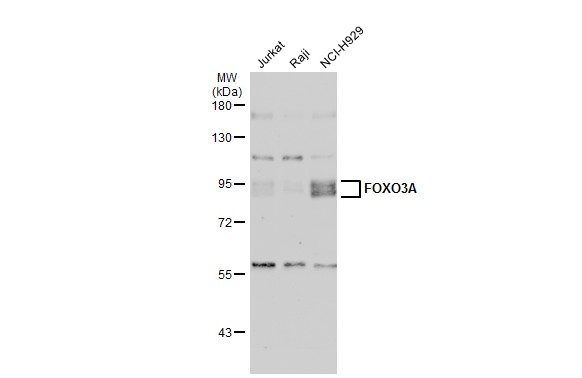 Sample (50 ug of whole cell lysate) A: Mouse brain 7.5% SDS PAGE GTX100277 diluted at 1:500 The HRP-conjugated anti-rabbit IgG antibody (GTX213110-01) was used to detect the primary antibody.