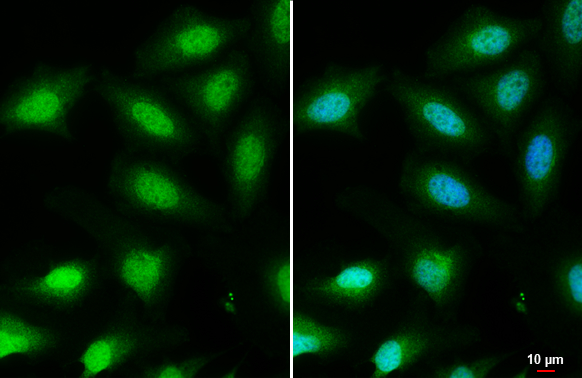 FOXO3A antibody [C3], C-term detects FOXO3A protein at nucleus by immunofluorescent analysis. Sample: HeLa cells were fixed in 4% paraformaldehyde at RT for 15 min. Green: FOXO3A stained by FOXO3A antibody [C3], C-term (GTX100277) diluted at 1:1000. Blue: Hoechst 33342 staining. Scale bar= 10 μm.