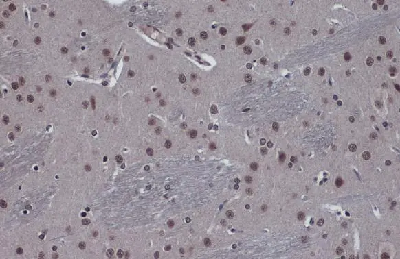 Anti-FOXO3A antibody [C3], C-term (GTX100277) | GeneTex