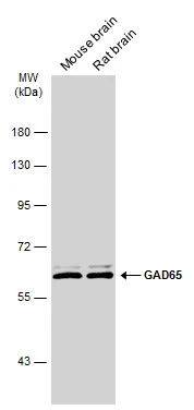 Various tissue extracts (50 μg) were separated by 7.5% SDS-PAGE, and the membrane was blotted with GAD65 antibody [C2C3], C-term (GTX100281) diluted at 1:5000. The HRP-conjugated anti-rabbit IgG antibody (GTX213110-01) was used to detect the primary antibody.