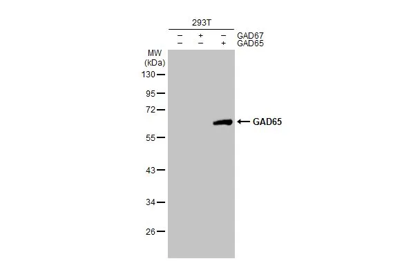 Non-transfected (–) and transfected (+) 293T whole cell extracts (30 μg) were separated by 10% SDS-PAGE, and the membrane was blotted with GAD65 antibody [C2C3], C-term (GTX100281) diluted at 1:100000. The HRP-conjugated anti-rabbit IgG antibody (GTX213110-01) was used to detect the primary antibody.