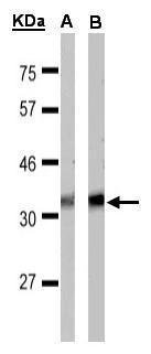 Immunohistochemical analysis of paraffin-embedded human uterus,myometrium,using GPR40(GTX100290) antibody(10 ug/ml). Antigen Retrieval: Trilogy? (EDTA based,pH 8.0) buffer,15min