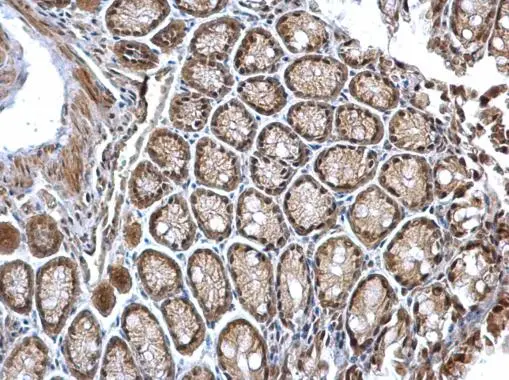 CSN1 antibody [C3], C-term detects CSN1 protein at nucleus on mouse colon by immunohistochemical analysis. Sample: Paraffin-embedded mouse colon. CSN1 antibody [C3], C-term (GTX100291) dilution: 1:500. 
 Antigen Retrieval: Trilogy? (EDTA based, pH 8.0) buffer, 15min