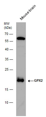 GPX2 antibody detects GPX2 protein by Western blot analysis. Mouse tissue extracts (50 μg) was separated by 12 % SDS-PAGE, and blotted with GPX2 antibody (GTX100292) diluted by 1:500