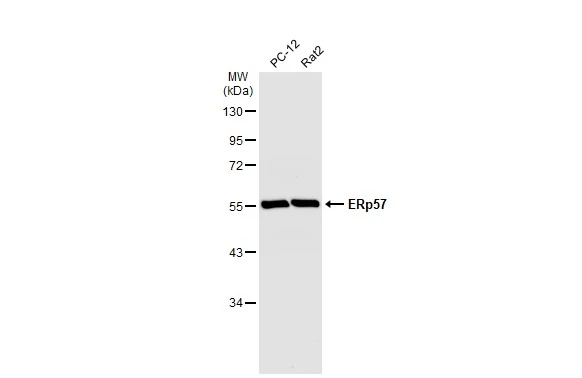 Various whole cell extracts (30 μg) were separated by 10% SDS-PAGE, and the membrane was blotted with ERp57 antibody [C3], C-term (GTX100297) diluted at 1:10000. The HRP-conjugated anti-rabbit IgG antibody (GTX213110-01) was used to detect the primary antibody.
