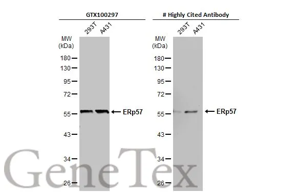 Various whole cell extracts (30 μg) were separated by 10% SDS-PAGE, and the membranes were blotted with ERp57 antibody [C3], C-term (GTX100297) diluted at 1:5000 and competitor's antibody diluted at 1:5000. The HRP-conjugated anti-rabbit IgG antibody (GTX213110-01) was used to detect the primary antibody. *The competitor is not affiliated with GeneTex and does not endorse this product.