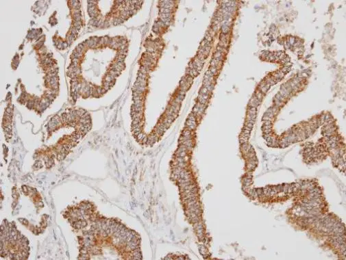 ERAB antibody detects ERAB protein at mitochondria on mouse prostate by immunohistochemical analysis. Sample: Paraffin-embedded mouse prostate. ERAB antibody (GTX100301) dilution: 1:500.  Antigen Retrieval: Trilogy? (EDTA based,pH 8.0) buffer,15min