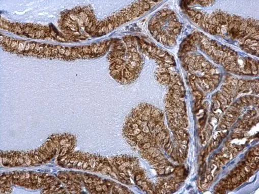 ERAB antibody detects ERAB protein at mitochondria on mouse prostate by immunohistochemical analysis. Sample: Paraffin-embedded mouse prostate. ERAB antibody (GTX100301) dilution: 1:500. 
 Antigen Retrieval: Trilogy? (EDTA based, pH 8.0) buffer, 15min