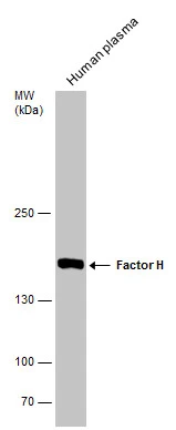 Human tissue extract (30 μg) was separated by 5% SDS-PAGE, and the membrane was blotted with Factor H antibody [N3C1], Internal (GTX100305) diluted at 1:500.