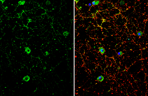 Dopamine Receptor D1 antibody [C2C3], C-term detects Dopamine Receptor D1 protein by immunofluorescent analysis. Sample: DIV10 rat E18 primary cortical neuron cells were fixed in 4% paraformaldehyde at RT for 15 min. Green: Dopamine Receptor D1 stained by Dopamine Receptor D1 antibody [C2C3], C-term (GTX100354) diluted at 1:500. Red: beta Tubulin 3/ Tuj1, stained by beta Tubulin 3/ Tuj1 antibody [GT11710] (GTX631836) diluted at 1:500. Blue: Fluoroshield with DAPI (GTX30920).