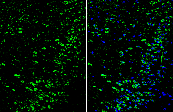 Dopamine Receptor D1 antibody [C2C3], C-term detects Dopamine Receptor D1 protein by immunohistochemical analysis. Sample: Frozen-sectioned mouse cerebral cortex. Green: Dopamine Receptor D1 stained by Dopamine Receptor D1 antibody [C2C3], C-term (GTX100354) diluted at 1:250. Blue: Fluoroshield with DAPI (GTX30920).