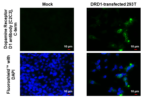 Anti-Dopamine Receptor D1 antibody [C2C3], C-term (GTX100354
