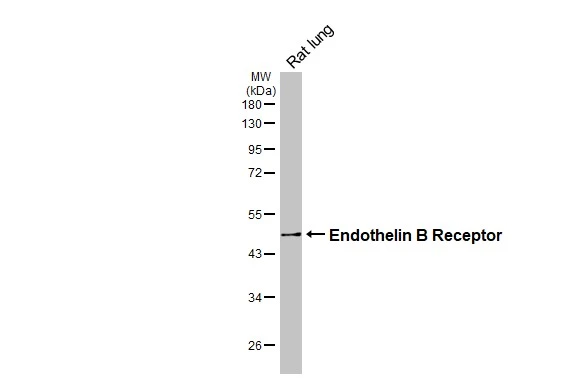 Rat tissue extract (50 μg) was separated by 10% SDS-PAGE, and the membrane was blotted with Endothelin B Receptor antibody (GTX100357) diluted at 1:1000. The HRP-conjugated anti-rabbit IgG antibody (GTX213110-01) was used to detect the primary antibody.