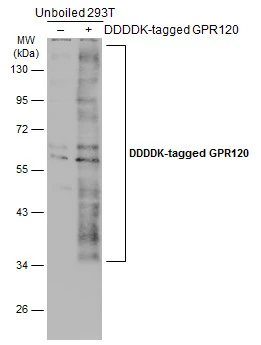 GPR120 antibody [N1N2],N-term detects GPR120 protein at cytoplasm by immunohistochemical analysis.