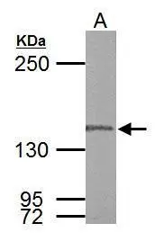 DNA polymerase gamma antibody detects POLG protein by western blot analysis. A. 50 μg Rat testis lysate/extract 5% SDS-PAGE DNA polymerase gamma antibody (GTX100398) dilution: 1:1000 The HRP-conjugated anti-rabbit IgG antibody (GTX213110-01) was used to detect the primary antibody.