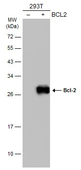 Non-transfected (–) and transfected (+) 293T whole cell extracts (30 μg) were separated by 12% SDS-PAGE, and the membrane was blotted with Bcl-2 antibody (GTX100440) diluted at 1:500. The HRP-conjugated anti-rabbit IgG antibody (GTX213110-01) was used to detect the primary antibody.