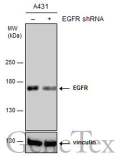 Non-transfected (–) and transfected (+) A431 whole cell extracts (15 μg) were separated by 5% SDS-PAGE, and the membrane was blotted with EGFR antibody [C2C3], C-term (GTX100448) diluted at 1:6000. The HRP-conjugated anti-rabbit IgG antibody (GTX213110-01) was used to detect the primary antibody.