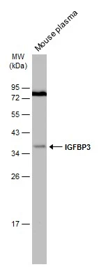 Mouse plasma (30 μg) was separated by 12% SDS-PAGE, and the membrane was blotted with IGFBP3 antibody (GTX100454) diluted at 1:1000. The HRP-conjugated anti-rabbit IgG antibody (GTX213110-01) was used to detect the primary antibody.