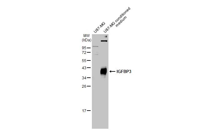 U87-MG whole cell extract and conditioned medium (30 μg) were separated by 12% SDS-PAGE, and the membrane was blotted with IGFBP3 antibody [N2C3] (GTX100454) diluted at 1:1000. The HRP-conjugated anti-rabbit IgG antibody (GTX213110-01) was used to detect the primary antibody, and the signal was developed with Trident ECL plus-Enhanced.