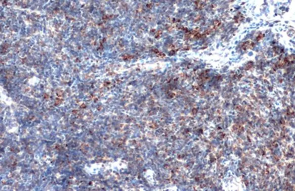 MMP9 antibody [N2C1], Internal detects MMP9 protein at cytoplasm by immunohistochemical analysis. Sample: Paraffin-embedded mouse lymph node. MMP9 stained by MMP9 antibody [N2C1], Internal (GTX100458) diluted at 1:500. Antigen Retrieval: Citrate buffer, pH 6.0, 15 min