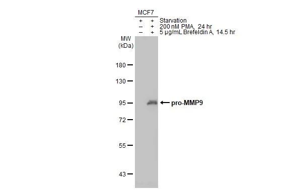 Untreated (–) and treated (+) MCF-7 whole cell extracts (30 μg) were separated by 7.5% SDS-PAGE, and the membrane was blotted with MMP9 antibody [N2C1], Internal (GTX100458) diluted at 1:1000. The HRP-conjugated anti-rabbit IgG antibody (GTX213110-01) was used to detect the primary antibody.