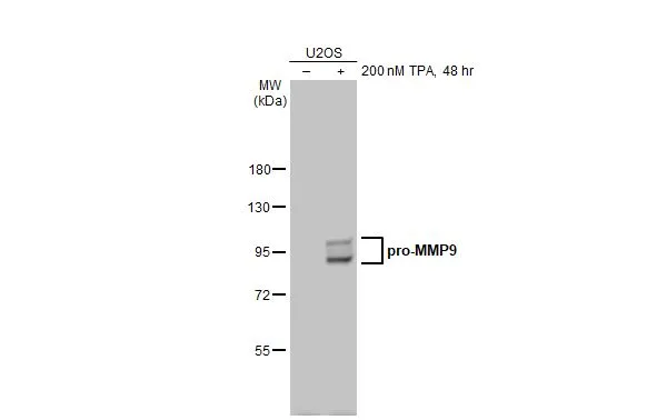 Untreated (–) and treated (+) U2OS whole cell extracts (30 μg) were separated by 7.5% SDS-PAGE, and the membrane was blotted with MMP9 antibody [N2C1], Internal (GTX100458) diluted at 1:1000. The HRP-conjugated anti-rabbit IgG antibody (GTX213110-01) was used to detect the primary antibody.