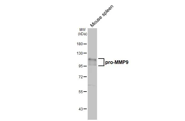 Mouse tissue extract (50 μg) was separated by 7.5% SDS-PAGE, and the membrane was blotted with MMP9 antibody [N2C1], Internal (GTX100458) diluted at 1:1000. The HRP-conjugated anti-rabbit IgG antibody (GTX213110-01) was used to detect the primary antibody.