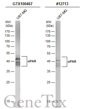 Whole cell extract (30 μg) was separated by 12% SDS-PAGE, and the membranes were blotted with uPAR antibody (GTX100467) diluted at 1:500 and competitor's antibody (CST#12713) diluted at 1:200. The HRP-conjugated anti-rabbit IgG antibody (GTX213110-01) was used to detect the primary antibody.