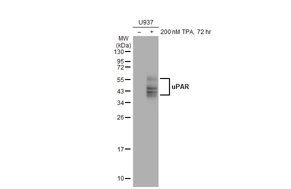 Untreated (–) and treated (+) U937 whole cell extracts (30 μg) were separated by 12% SDS-PAGE, and the membrane was blotted with uPAR antibody (GTX100467) diluted at 1:1000. The HRP-conjugated anti-rabbit IgG antibody (GTX213110-01) was used to detect the primary antibody.