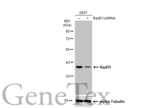 Non-transfected (�) and transfected (+) 293T whole cell extracts (30 ug) were separated by 10% SDS-PAGE,and the membrane was blotted with Rad51 antibody [N1C2] (GTX100469) diluted at 1:500.