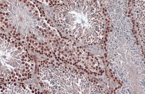 Anti-Rad51 antibody [N1C2] (GTX100469) | GeneTex