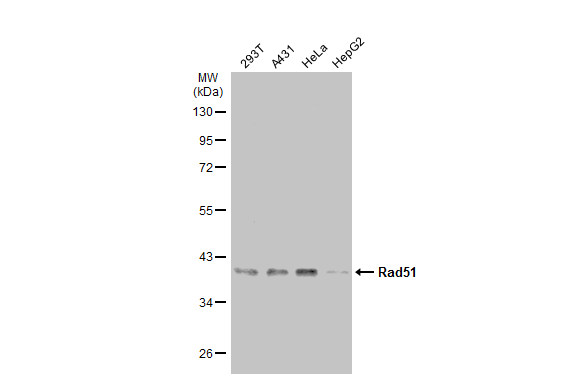 Non-transfected (�) and transfected (+) 293T whole cell extracts (30 ug) were separated by 10% SDS-PAGE,and the membrane was blotted with Rad51 antibody [N1C2] (GTX100469) diluted at 1:500.