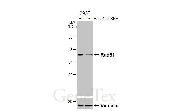 Anti-Rad51 antibody [N1C2] (GTX100469) | GeneTex