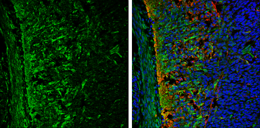 ABAT antibody detects ABAT protein expression by immunohistochemical analysis. Sample: Frozen sectioned E13.5 Rat brain. Green: ABAT protein stained by ABAT antibody (GTX100479) diluted at 1:250. Red: beta Tubulin 3/ TUJ1, a mature neuron marker, stained by beta Tubulin 3/ TUJ1 antibody [GT11710] (GTX631836) diluted at 1:500. Blue: Fluoroshield with DAPI (GTX30920).