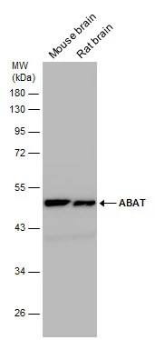 Various tissue extracts (50 μg) were separated by 10% SDS-PAGE, and the membrane was blotted with ABAT antibody (GTX100479) diluted at 1:10000. The HRP-conjugated anti-rabbit IgG antibody (GTX213110-01) was used to detect the primary antibody.